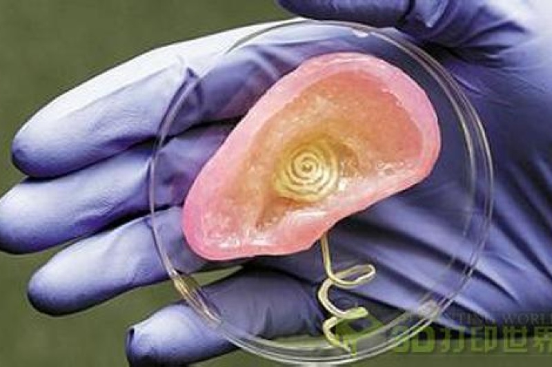 3D打印能引领医疗界的一场革新革命吗？
