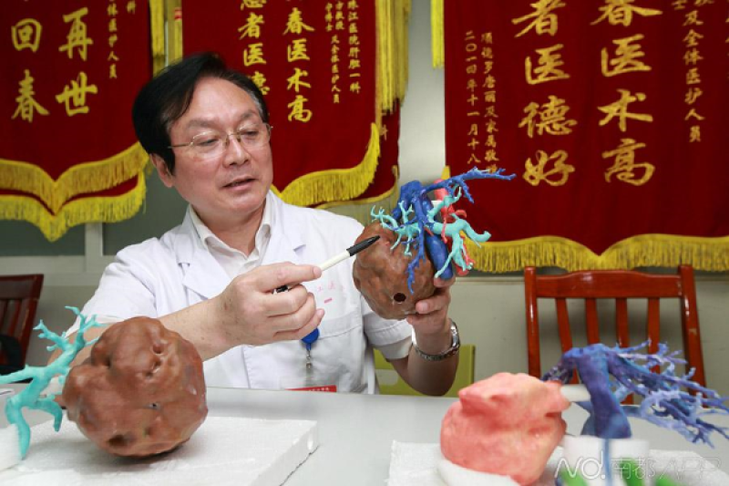 广州实施全国首例3D打印指导复杂肝切除术