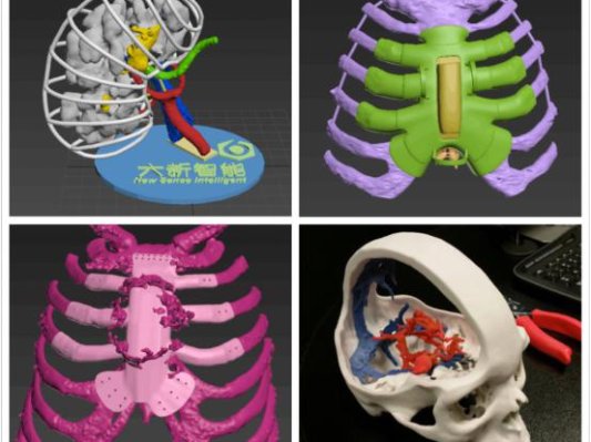 探秘数字化3D医疗应用