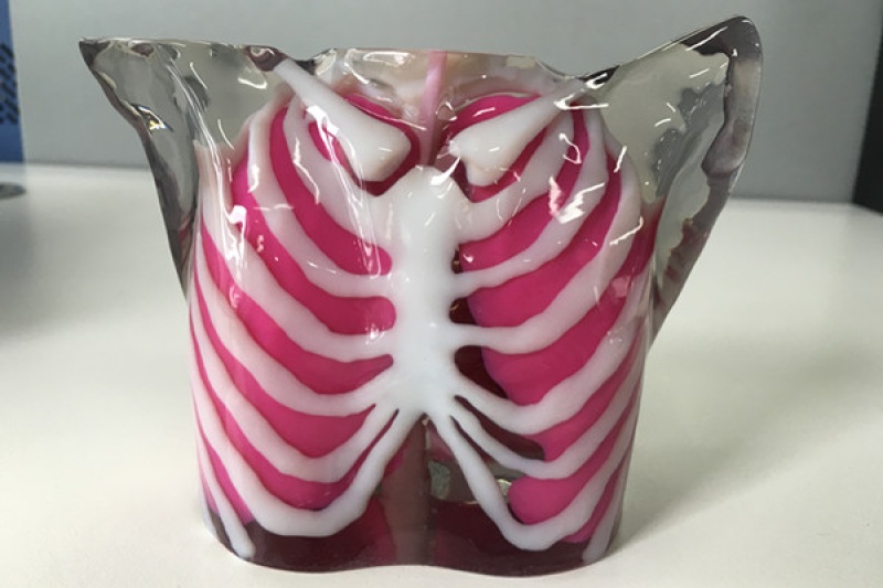 “计算机模拟及3D打印技术在心血管血流动力学研究上的应用”学术研讨会在沪举行
