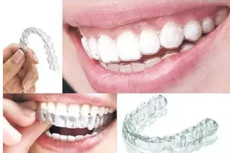 隐形矫治器的时代，3D打印如何大显神通？