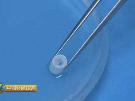 央视披露大量细节："四川造"3D打印血管在猴体内实验成功