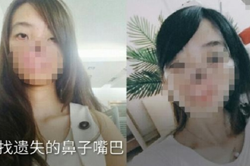 27岁女子换脸：上海九院医生在其胸部用3D打印造脸