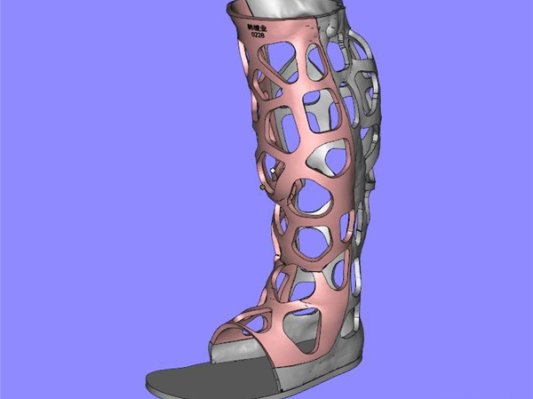 塑成医疗｜3D打印技术在骨科康复治疗中的应用