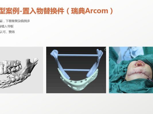 国内专注于3D数字化医疗应用研究的专业团队，看看他们有哪些精彩案例？