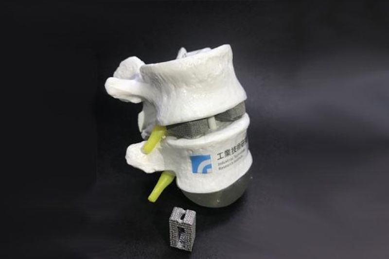 骄傲脸！台湾工研院研发专为国人设计的3D打印仿生骨结构，预计明年年底推出