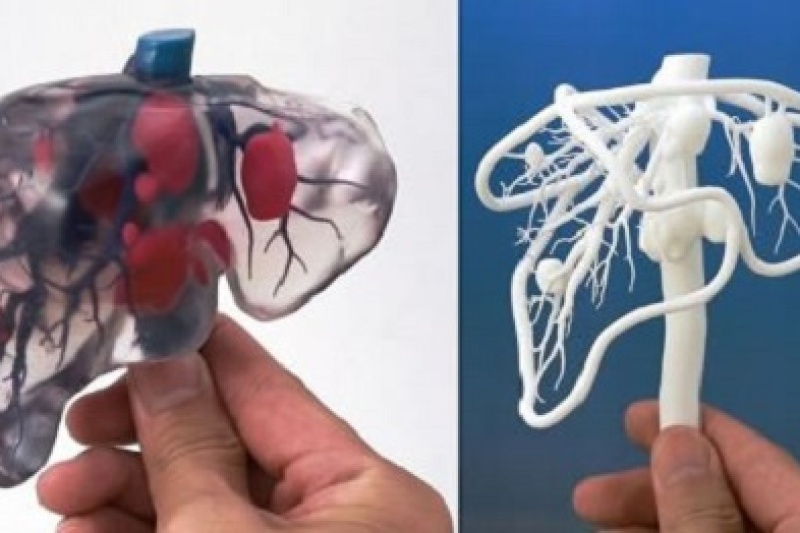 医学3D打印机的重大发现“仿生胰腺”